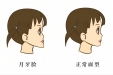 孩子是否需要带“牙套”？这篇一次说清楚