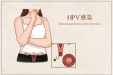 万万没想到！用对方法后，HPV转阴竟如此简单