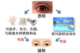 “红眼病”看一眼就被传染？真相在这儿