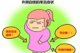 女性难言之隐别害怕，我院妇科医生来支招！