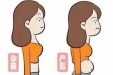 平肚腩、祛妊娠纹… 这家医院的“躺瘦”神器让你变身时髦精