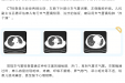 舒适化诊疗 | 无痛支气管镜技术，让患者不再恐惧检查与治疗！