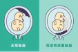 踩在刀尖上的手术——我院多学科联合为凶险性前置胎盘孕妈妈保驾护航！