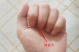注意 | 一到夏天手上就长出的“小水泡”到底是什么？了解清楚才能避免发作