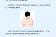 那些你不知道的“男”言之隐——男性乳腺发育症