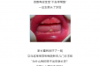 刚出生的小宝宝，竟然长了两颗牙！