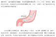 备孕遇难题？经阴道注水腹腔镜为患者打开幸“孕”之路